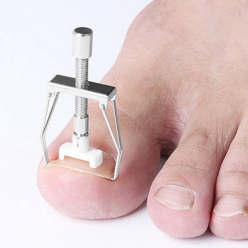 Para Unhas Encravadas Fixador De Fio De Dedo