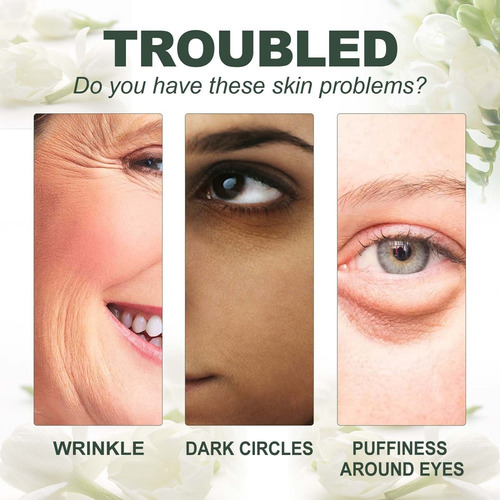 4×crema Ojos Para Eliminar Ojeras Con Jazmín, Ojeras, Ojera