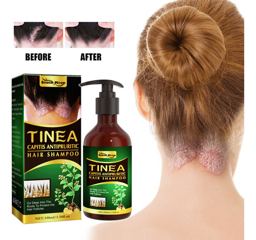 3×shampoo Seborreico Para Tratamento Dermatites E