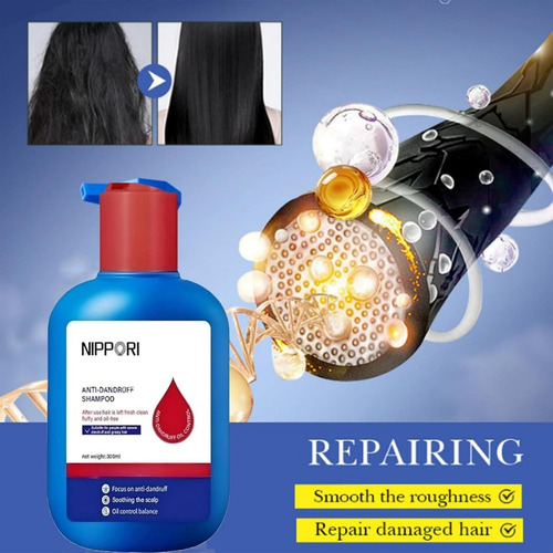 Shampoo Nipori, Refrescante Anticaspa E Anti-coceira Para C