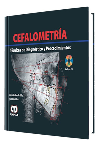 Cefalometría. Técnicas De Diagnóstico Y Procedimientos.