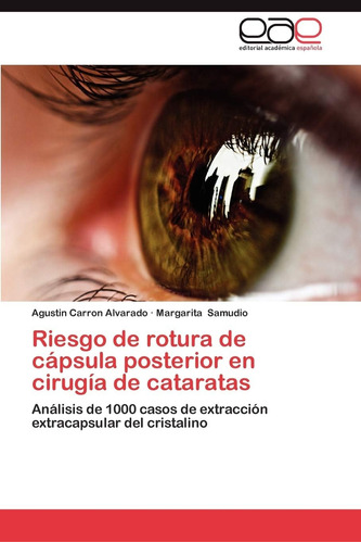 Libro: Riesgo De Rotura De Cápsula Posterior En Cirugía De C