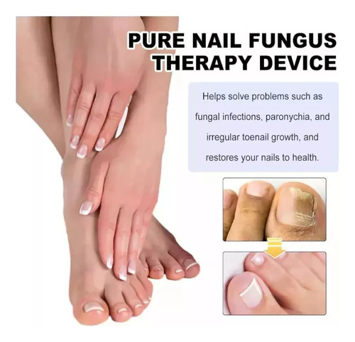 // Para Dispositivo De Terapia Láser Neatlif Para Hongos En