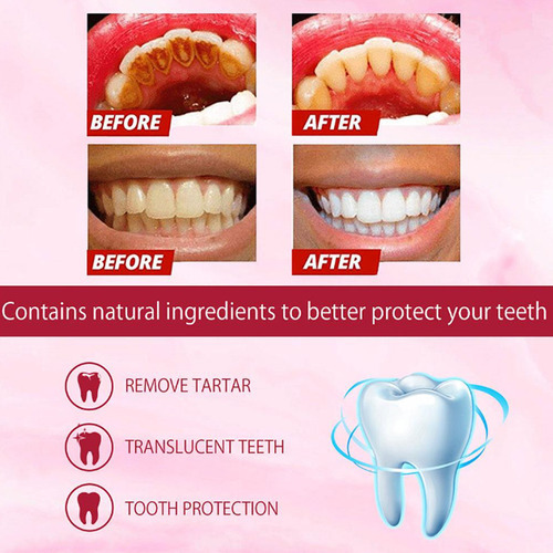 Pasta De Dientes Probiótica Sp-4, 3 Unidades, Para Blanquear