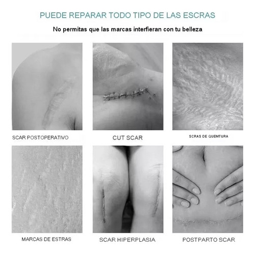 Gel Eliminador De Cicatrices B Go For Queloids, Repara.