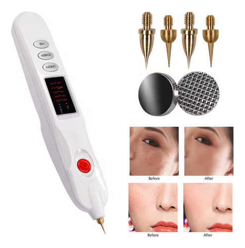 Beauty Monster Plasma Pen Electrocauterio Facial Y Corporal Blanco