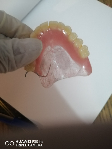 Imagen 4 de 5 de Prótesis Dentales, Reparaciones, Laboratorio Odontológico