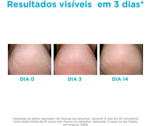 Hidratante para los Pies ISDIN Ureadin Podos DB Piel Diabética Con 102g