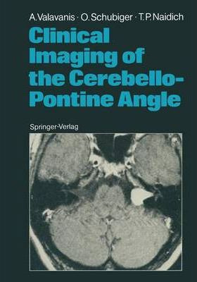Libro Clinical Imaging Of The Cerebello-pontine Angle - A...