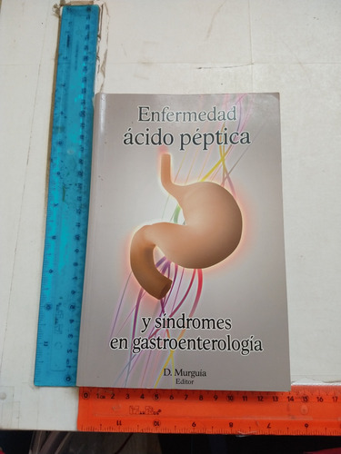 Enfermedad Acido Péptica Y Síndromes En Gastroenterología