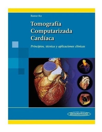 Tomografía Computarizada Cardíaca Principios Técnica Nuevo!