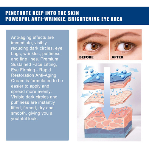 I La Crema For Ojos Con Colágeno Mejora Las Bolsas De Los