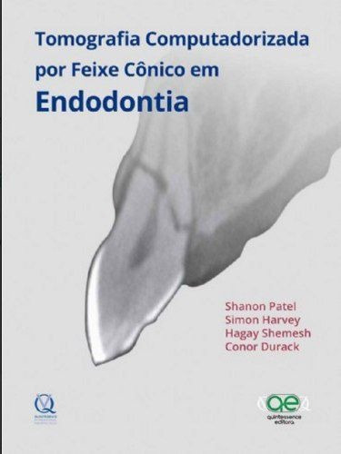 Tomografia Computadorizada Por Feixe Cônico Em Endodontia 