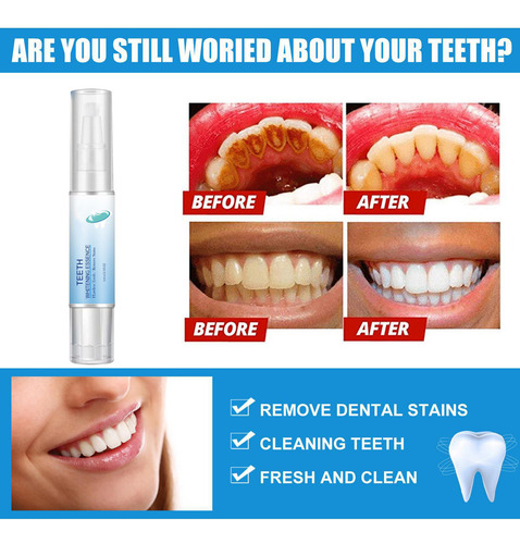 Bolígrafo Blanqueador De Dientes Giratorio T, 2 Piezas, Blan