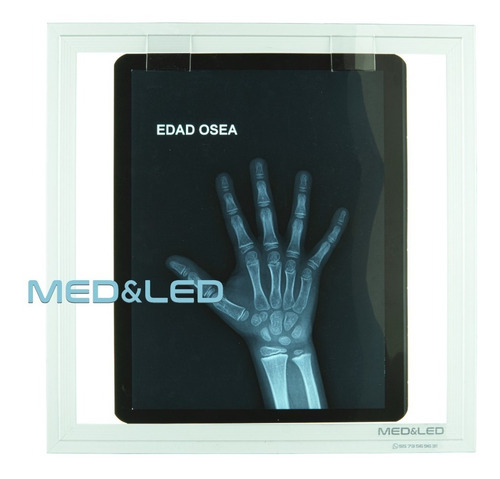 Negatoscopio Portátil Led 30x30cm Con Portaplacas Pesa 390gr