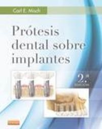 Libro Prã³tesis Dental Sobre Implantes (2âª Ed.)