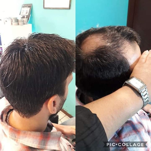 Imagen 3 de 4 de Scalp Protector Thick Walker Para Prótesis Capilar. Usa