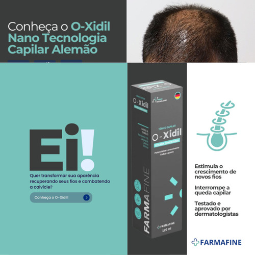 O-xidil Nano Tecnologia Capilar 120ml Farmafine