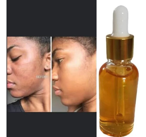 Aceite Corporal Para Sarpullido Facial Para Piel Milagrosa,