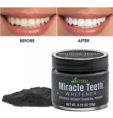 Imagen 4 de 5 de Blanqueador Dental Natural Polvo Carbón Dientes Blancos
