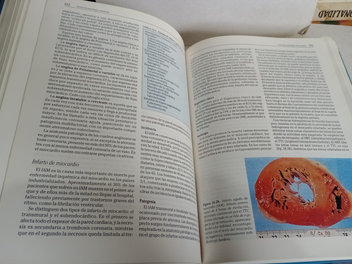 Anatomía Patológica Pardo (Usado)