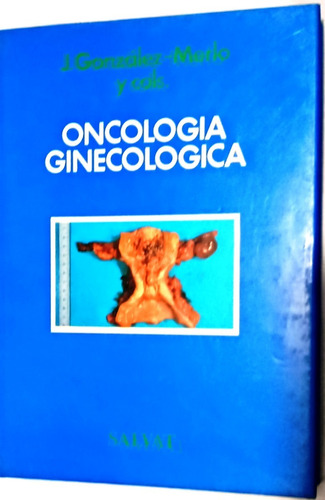 González-merlo. Oncología Ginecológica. 1991