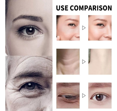 Crema Facial Qingling, Endurecedora Y Antipolipeptídica *1