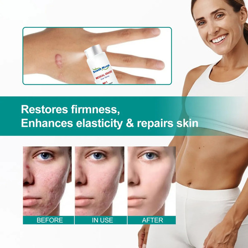 Gel Para Cicatrizes De Gravidez Dessalinizado E Dessalinizad