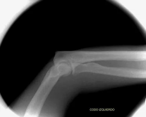 Equipo De Rayos X Nuevo Digital Directo Veterinario