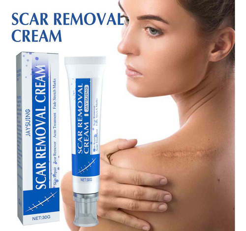 Fastest Removing And Scar Removing Cream Scar Gel Bruise Rep