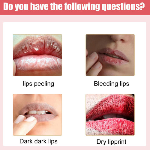 Creme Hidratante Clareador Labial Para Lábios Escuros