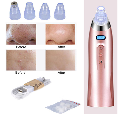 Aspiradora Eliminadora De Puntos Negros, Potente Exfoliante