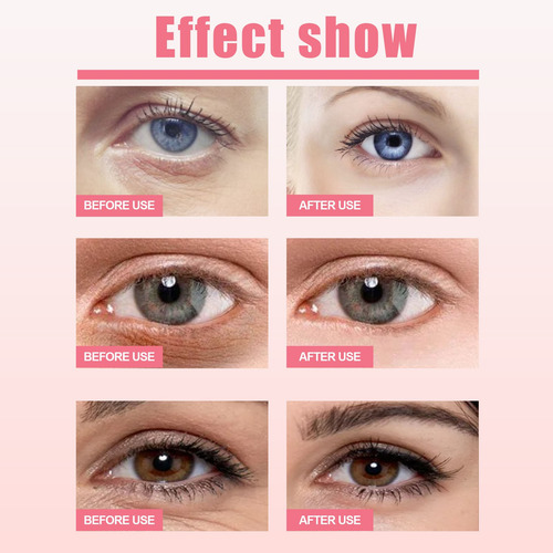 Bálsamo Para Ojos En Barra Para Diluir Las Bolsas De Los Ojo