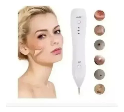 Quita Verrugas Corporal Y Genital Pecas Manchas Cuello