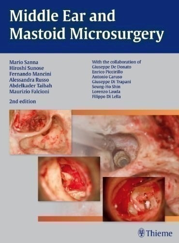 Middle Ear and Mastoid Microsurgery, de Sanna, Mario. Editorial Thieme Medical Publishers, edición 2012 en inglés