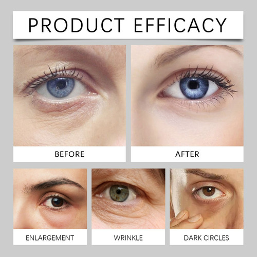 Crema De Ojos L Crema De Ojos Para Ojos Oscuros Crema Para L