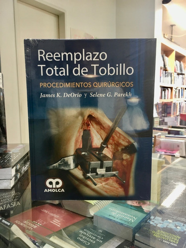 Reemplazo Total De Tobillo Procedimientos Quirúrgicos