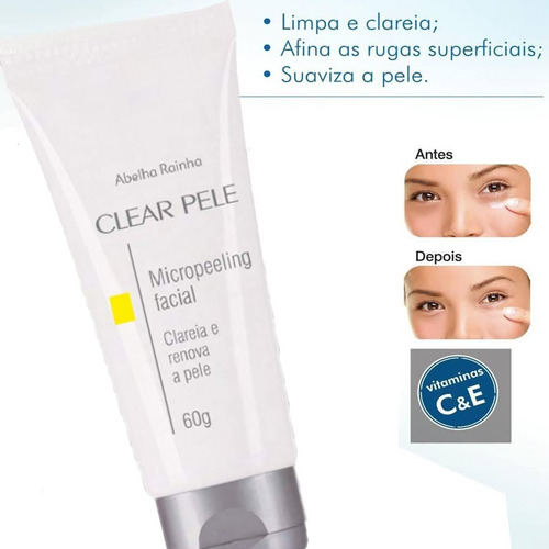 Micropeeling Facial Clareia E Renova A Pele Abelha Rainha Tipo De Pele Mista