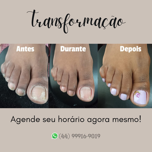 Imagem 3 de 5 de Manicure Pedicure E Spa Dos Pés