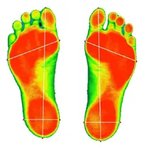 Comprar Pedigrafía Computarizada + Plantillas Ortopédicas Arco Scan