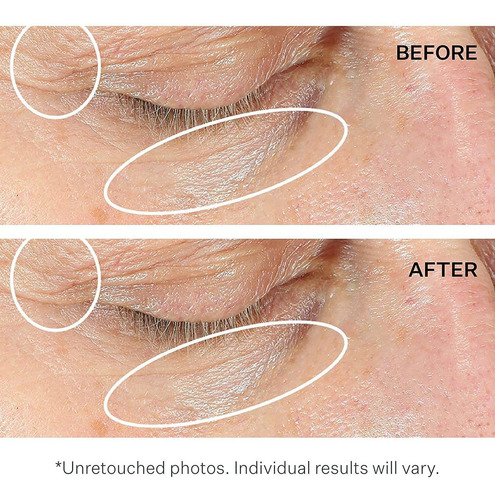 Strivectin Concentrado Intensivo Antiarrugas De Crema De Ojo