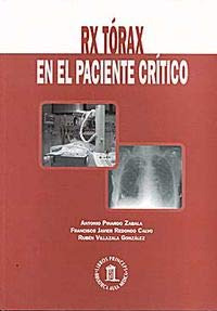 Libro  Rx Tórax En El Paciente Crítico De Antonio Pinardo Za