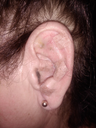 Imagen 2 de 5 de Auriculoterapia Y Podologia Basica
