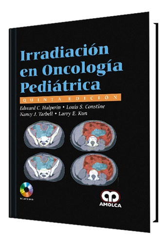 Irradiación En Oncología Pediátrica. 5ª Edición. Amolca