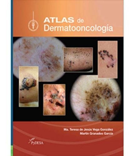 Atlas De Dermatooncologia