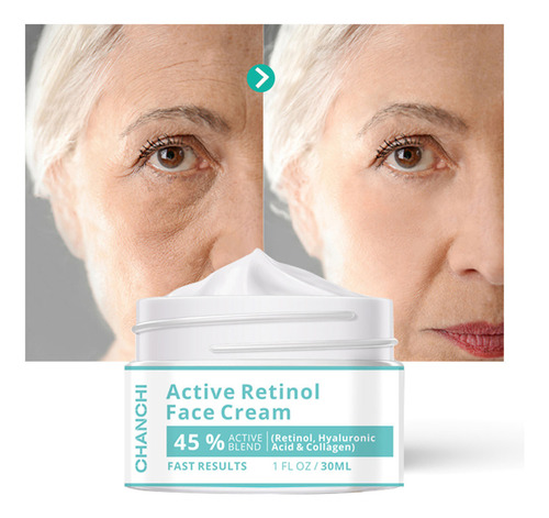 Creme Clareador De Retinol Ativo, Creme Facial De 30 Ml, Hid
