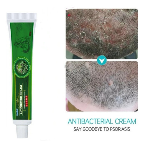 Crema Cuidado Piel Psoriasis Eczema Prurito Acné Zudaifu