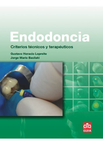 Endodoncia Criterios Tecnicos Y Terapeuticos