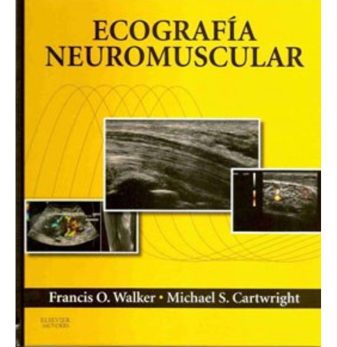 Ecografía Neuromuscular