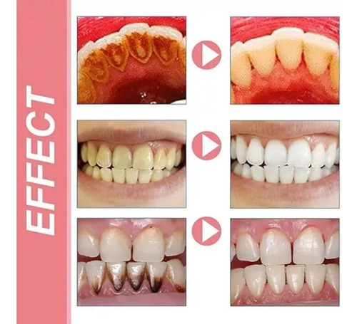 Zh Nueva Pasta Dientes Probiótica Fresca Y Blanqueadora Sp8